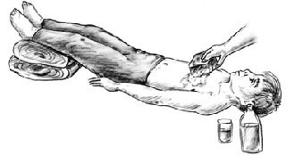 First Aid - Heat Exhaustion
