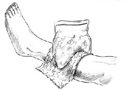 Primeros auxilios: compresa fría para lesión menor en la pie