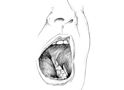First Aid - Tooth - Transport in Saliva