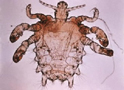 Pubic Louse
